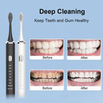 Electric Toothbrush II